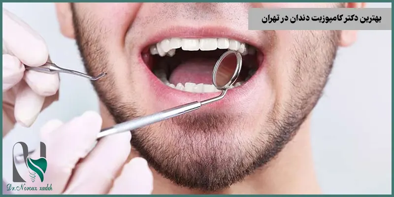 بهترین-دکتر-کامپوزیت-دندان
