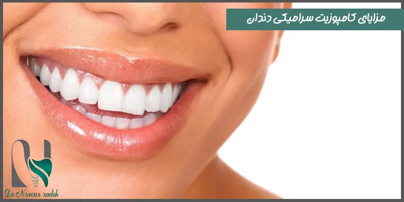 مزایای-کامپوزیت-سرامیکی-دندان