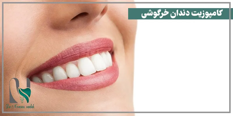 کاربرد-کامپوزیت-دندان-خرگوشی