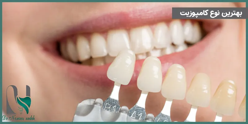 بهترین-نوع-کامپوزیت