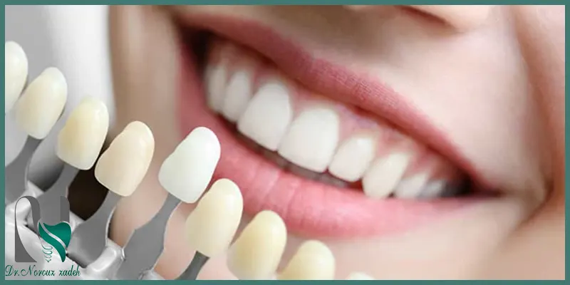 ویژگی-بهترین-نوع-کامپوزیت