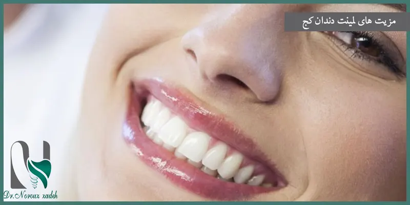 مزیت-های-لمینت-دندان-کج