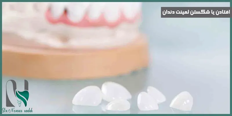 افتادن-یا-شکستن-لمینت-دندان