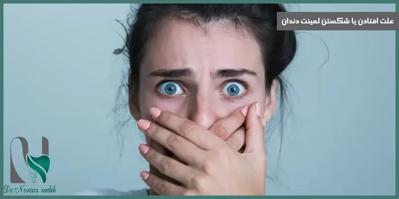 علت-افتادن-یا-شکستن-لمینت-دندان
